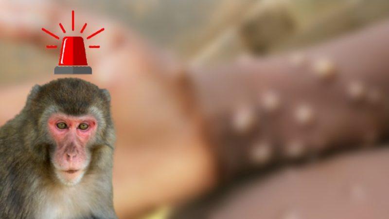 Dünya Sağlık Örgütü, Birçok Ülkede Görülen Maymun Çiçeği Virüsü İçin Acil Toplantı Yapacak