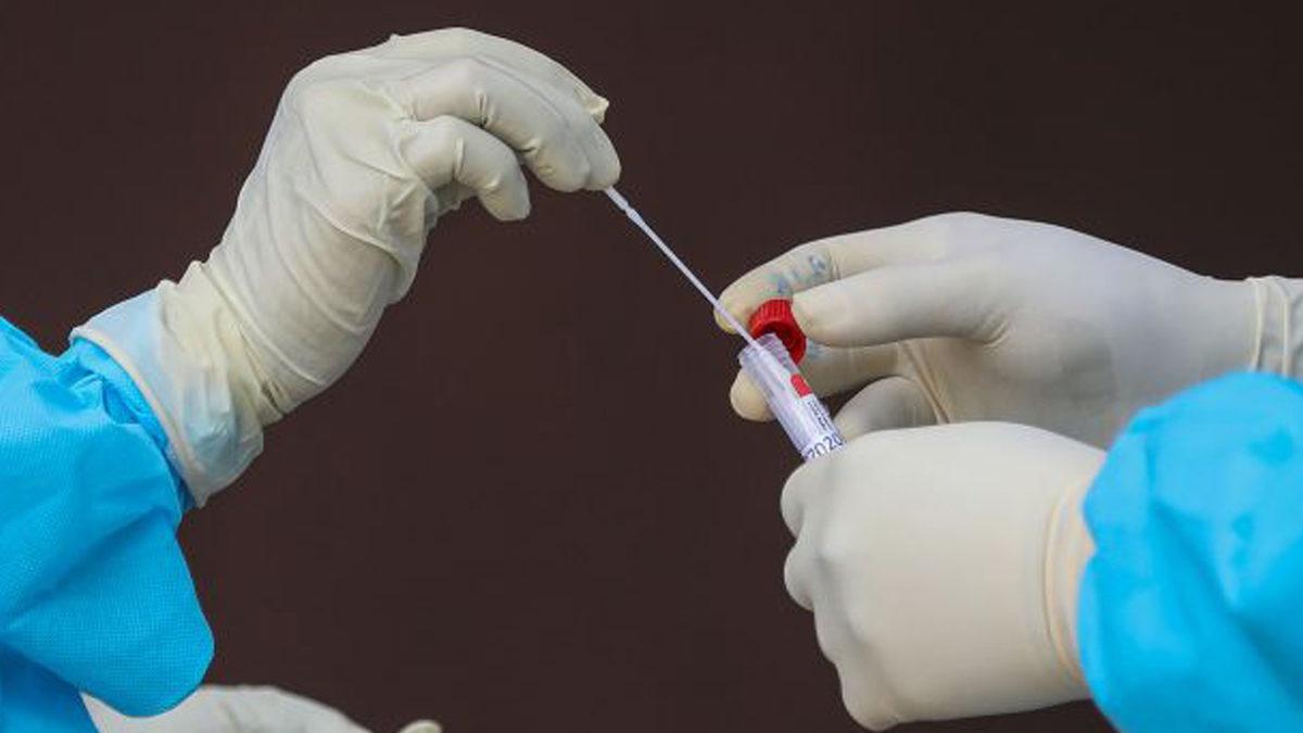 Çin, Anal COVID-19 Testini Ülke Geneline Yaymayı Planlıyor