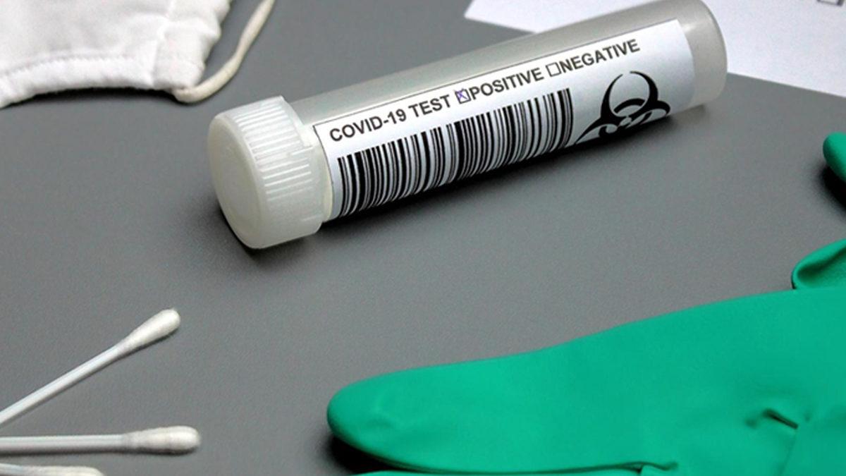 Çin, Anal COVID-19 Testini Ülke Geneline Yaymayı Planlıyor