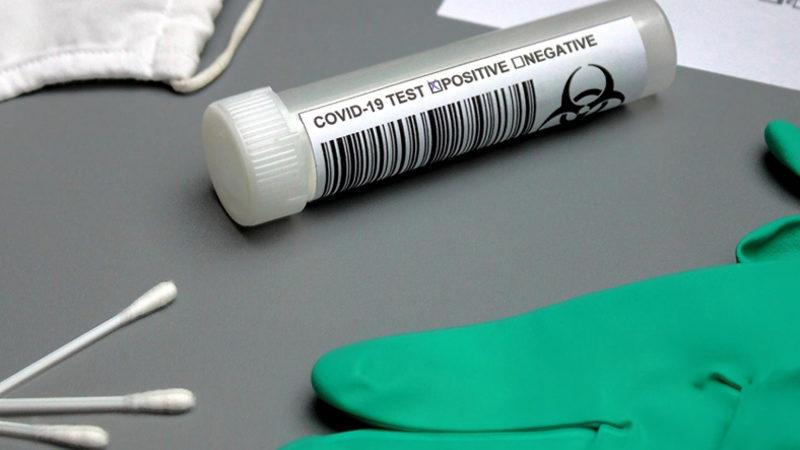 Çin, Anal COVID-19 Testini Ülke Geneline Yaymayı Planlıyor