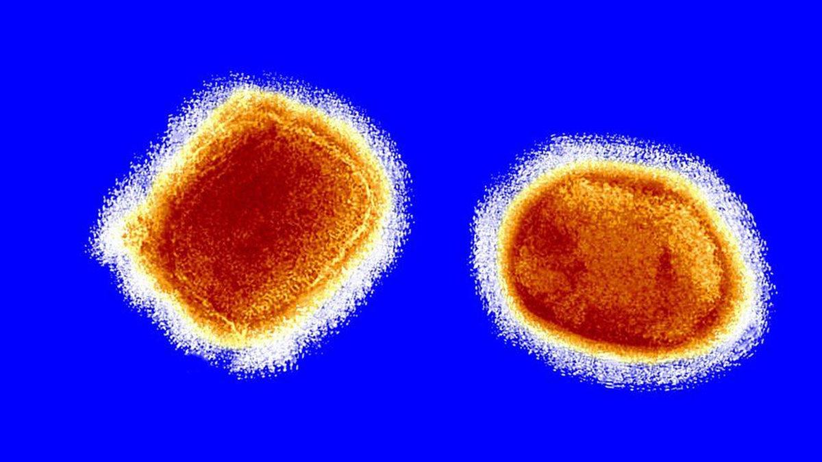 Maymun Çiçeği Virüsünün Görüldüğü Ülke Sayısı 15’e Çıktı