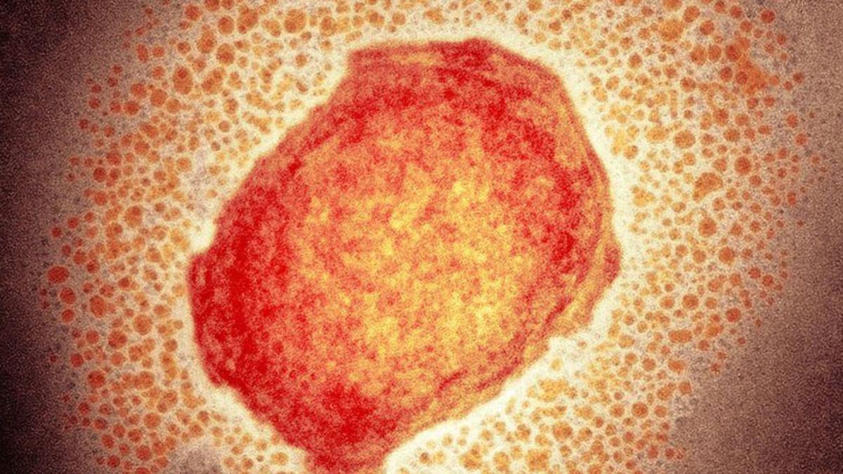Maymun Çiçeği Virüsünün Görüldüğü Ülke Sayısı 15’e Çıktı