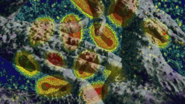 Maymun Çiçeği ile Yüz Milyonlarca İnsanı Öldüren Çiçek Hastalığı Arasındaki Fark Ne?