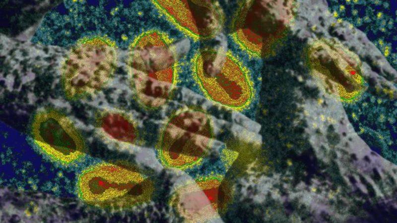 Maymun Çiçeği ile Yüz Milyonlarca İnsanı Öldüren Çiçek Hastalığı Arasındaki Fark Ne?