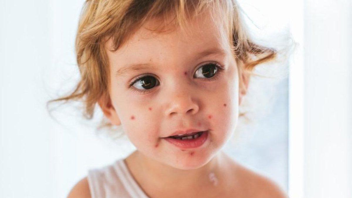 Milyonlarca İnsanın Hayatını Kurtararak Tarihin Seyrini Değiştiren Aşılar