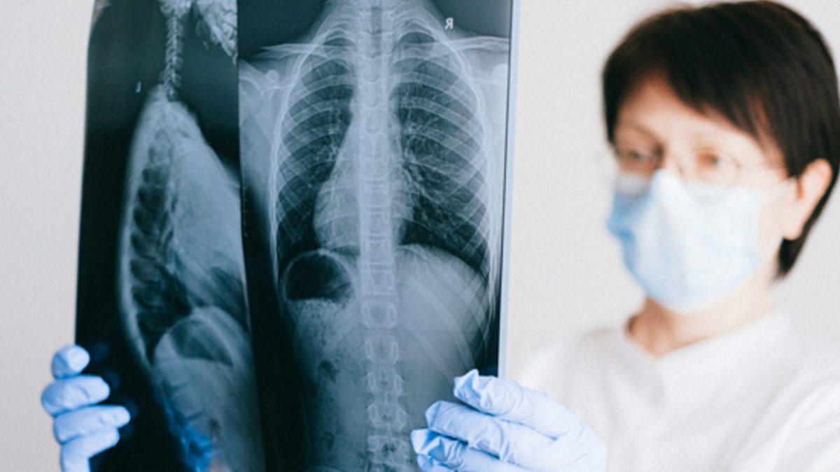 Milyonlarca İnsanın Hayatını Kurtararak Tarihin Seyrini Değiştiren Aşılar