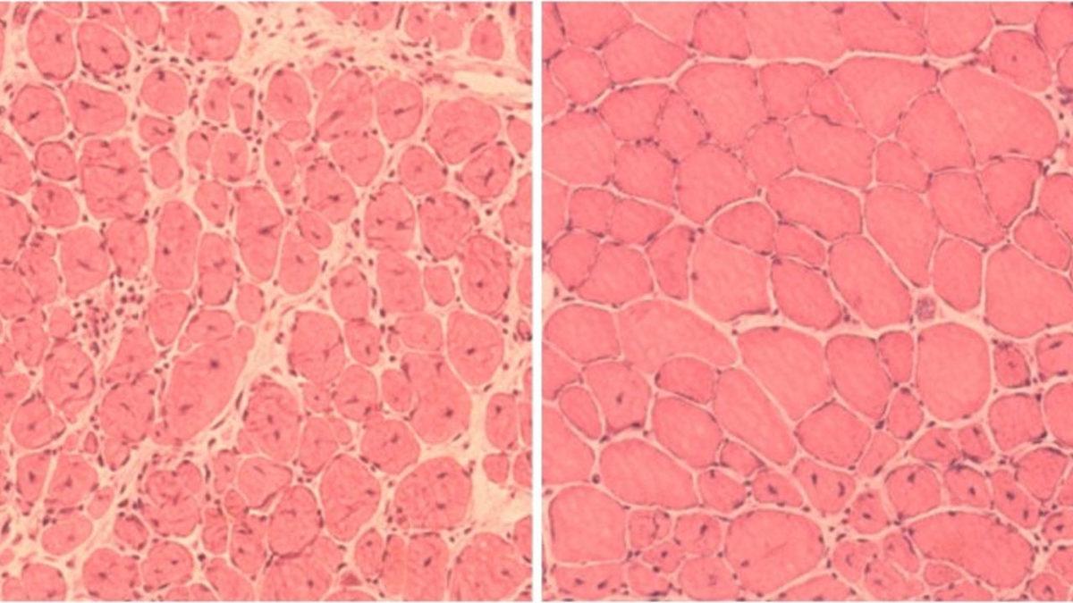 Yaşlanma Korkusunu Tarihe Karıştıracak 9 Bilimsel Keşif