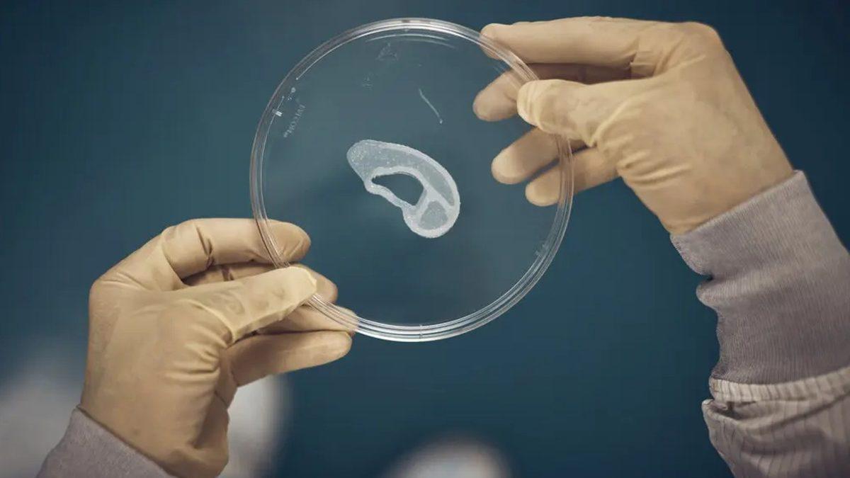 3D Yazıcıyla Elde Edilen Kulak, Bir İnsana Nakledildi: Tıp Dünyasında Bir Devrim Yaratabilir!