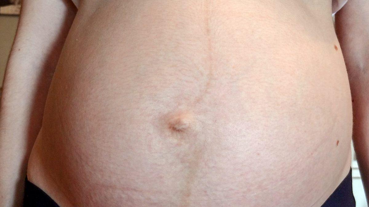 Neden Bazı İnsanların Göbek Deliği İçe Çökükken Bazılarının ise Dışa Çıkıktır?