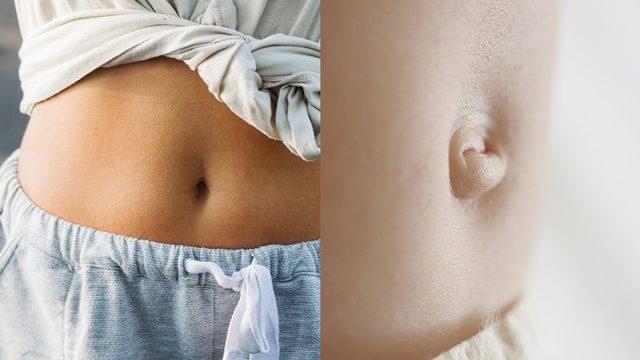 Neden Bazı İnsanların Göbek Deliği İçe Çökükken Bazılarının ise Dışa Çıkıktır?