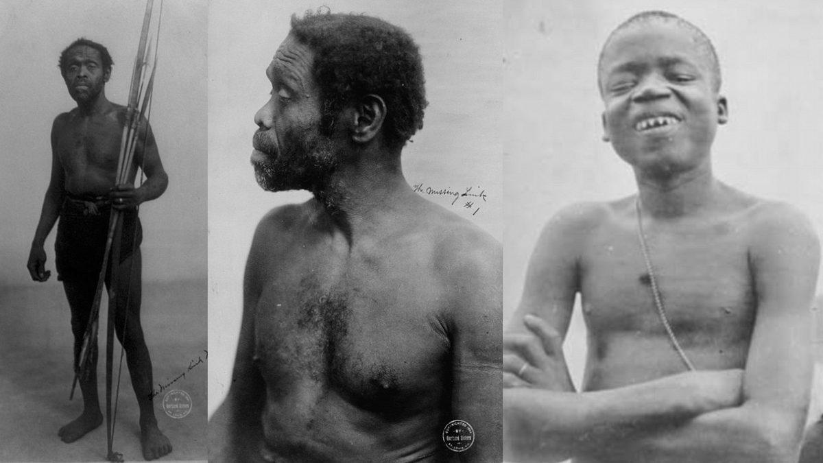 Bir Zamanlar Avrupa’da Açılan ’İnsanat Bahçelerinin’ Ürkütücü ve Trajik Hikayesi