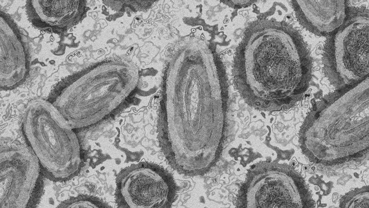 Maymun Çiçeği Vaka Sayısı Bir Haftada 3 Kat Arttı: Peki Endişelenmeli miyiz?