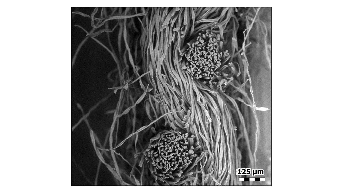 Bez Yüz Maskeleri Mikroskop Altında Nasıl Görünüyor?