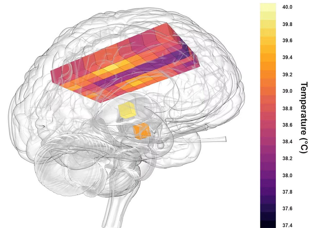 İnsan Beyninin İdeal Sıcaklığı Belli Oldu: Vücudumuz Gibi 36,5 Derece Değil!