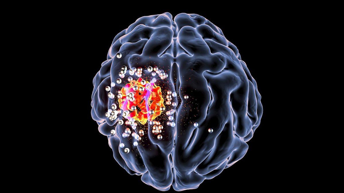 Yeni Bir Kanser Aşısı Geliştirildi: İnsanlar Üzerindeki İlk Deneylerde Başarı Oranı Yüzde 93