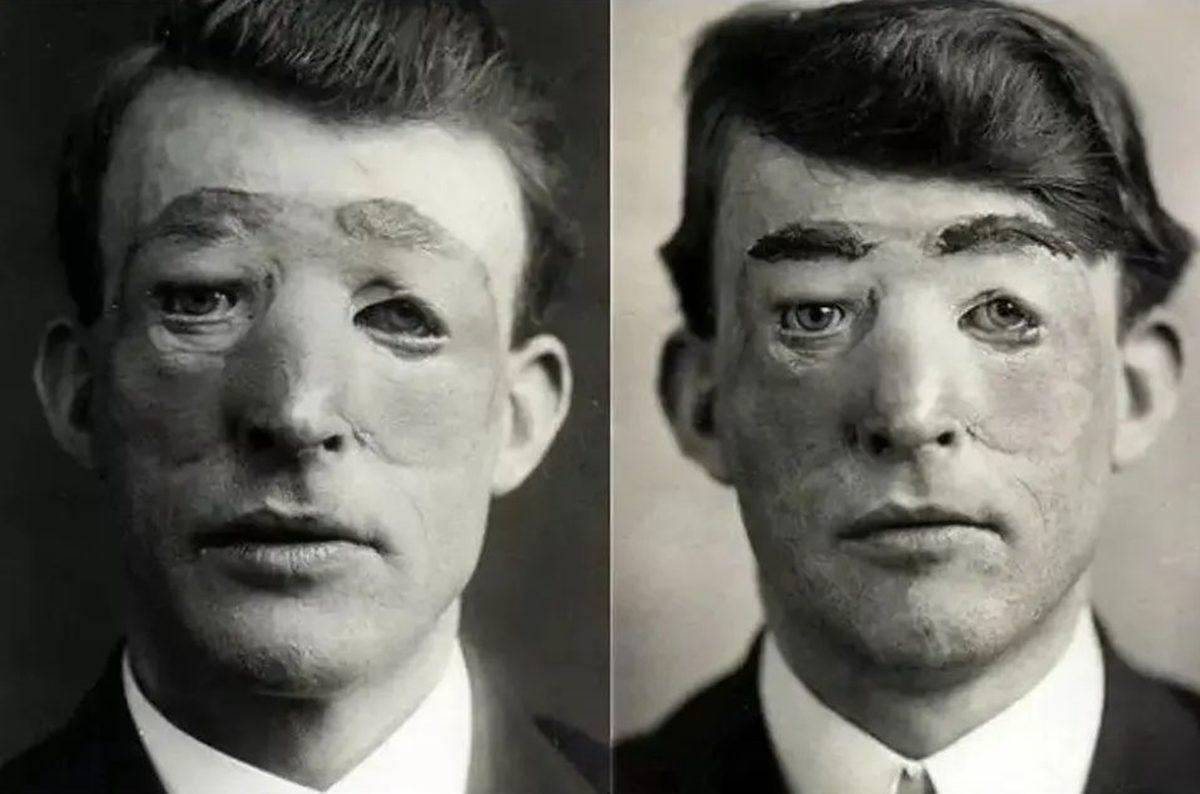 Görünce ’Keşke Gerçek Olmasaydı’ Dedirten 19 Rahatsız Edici ve Hassas Görüntü (18+)