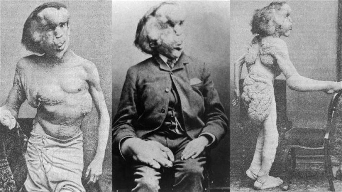 Görünce ’Keşke Gerçek Olmasaydı’ Dedirten 19 Rahatsız Edici ve Hassas Görüntü (18+)