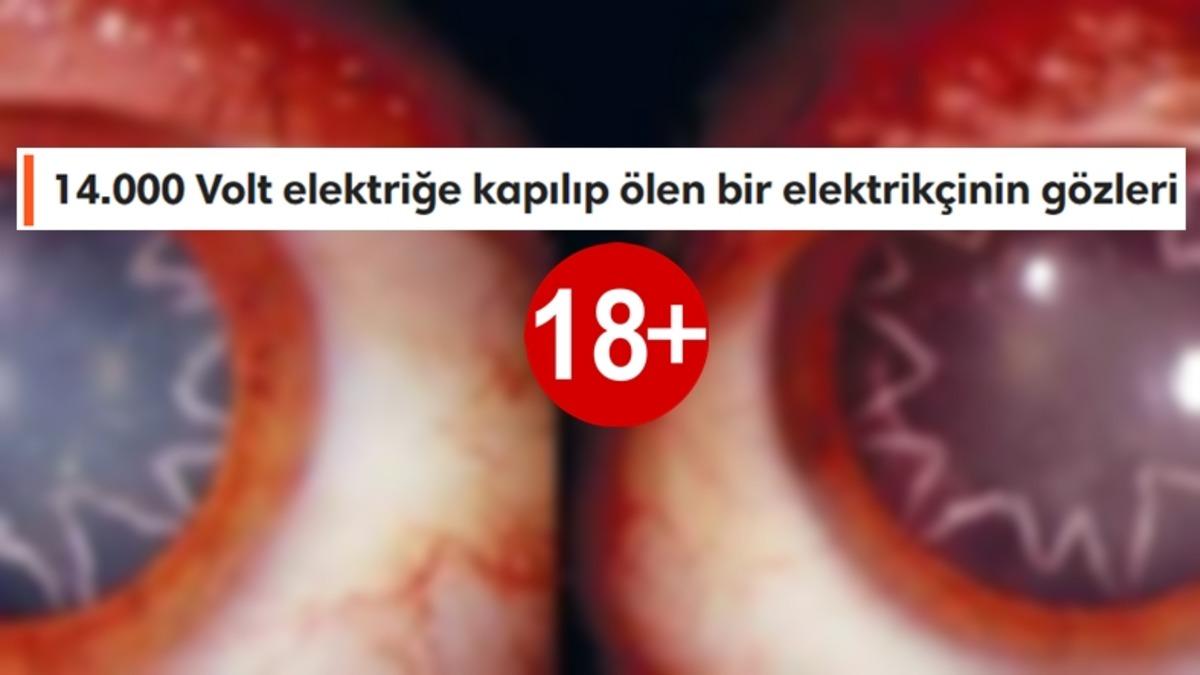 Görünce ’Keşke Gerçek Olmasaydı’ Dedirten 19 Rahatsız Edici ve Hassas Görüntü (18+)