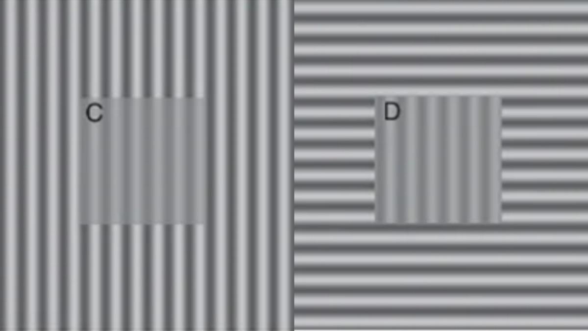 Yeni Bir Araştırmaya Göre Depresyonlu Kişiler, Dünyayı Farklı Görüyorlar