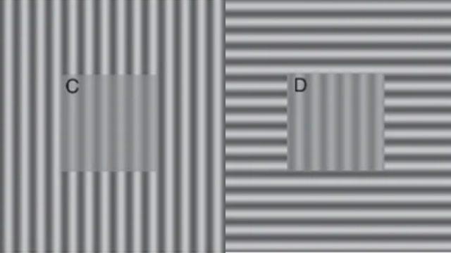 Yeni Bir Araştırmaya Göre Depresyonlu Kişiler, Dünyayı Farklı Görüyorlar