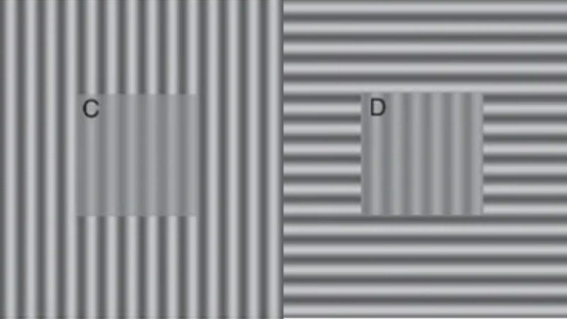 Yeni Bir Araştırmaya Göre Depresyonlu Kişiler, Dünyayı Farklı Görüyorlar