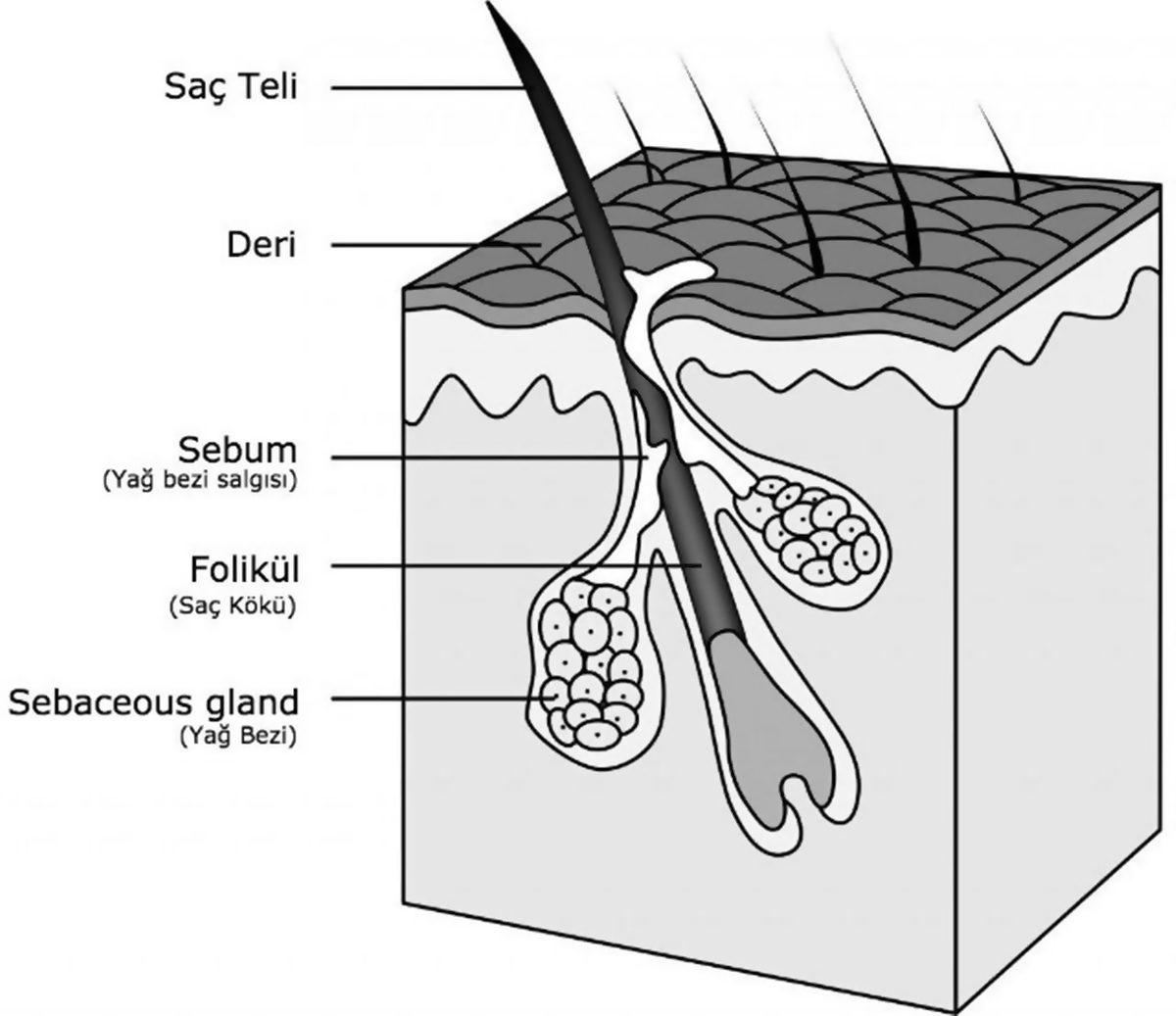 Kansere Yakalanan İnsanların Saçları Neden Bir Anda Dökülür?