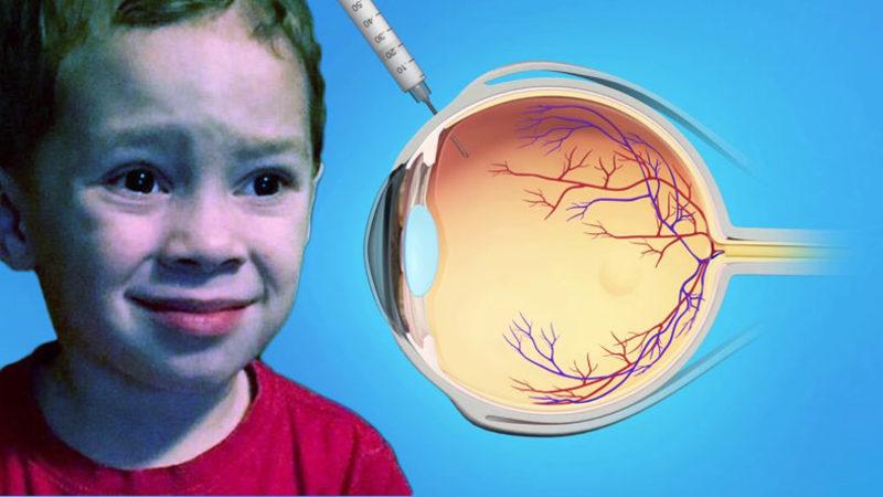 Gözümüze Aşı Olur Gibi İğne Vurulabilecek ’Daha Az Korkutucu’ Bir Yöntem Geliştirildi