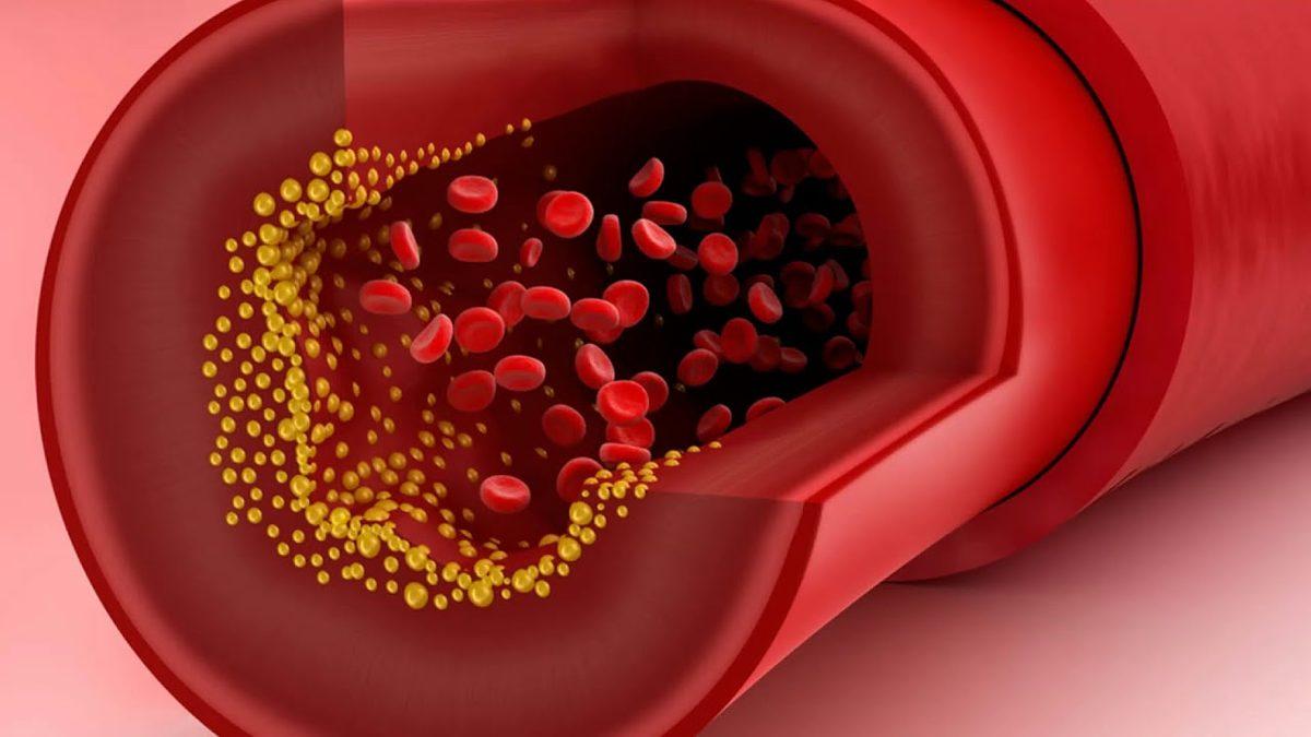 Vücudumuzun Enerji Deposu Olan ‘Trigliserit’ Aslında Nedir?