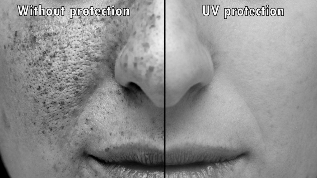 Güneş Kremi Kullanmazsanız Derinizin Ne Hale Gelebileceğini Gösteren Çarpıcı Sonuçlar! Peki Alırken Nelere Dikkat Etmeniz Gerekiyor?