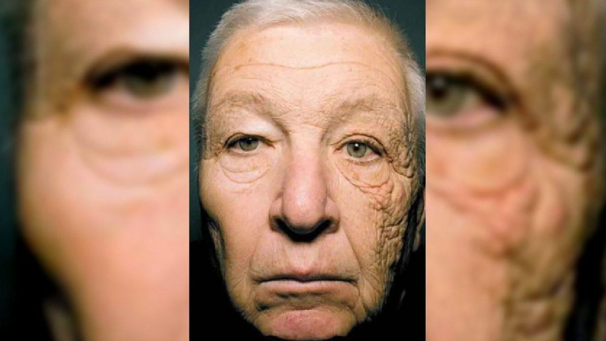 Güneş Kremi Kullanmazsanız Derinizin Ne Hale Gelebileceğini Gösteren Çarpıcı Sonuçlar! Peki Alırken Nelere Dikkat Etmeniz Gerekiyor?