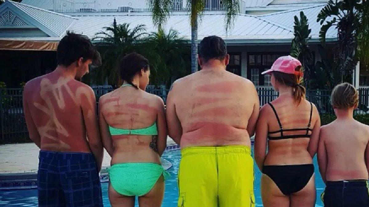 Güneş Kremi Kullanmazsanız Derinizin Ne Hale Gelebileceğini Gösteren Çarpıcı Sonuçlar! Peki Alırken Nelere Dikkat Etmeniz Gerekiyor?