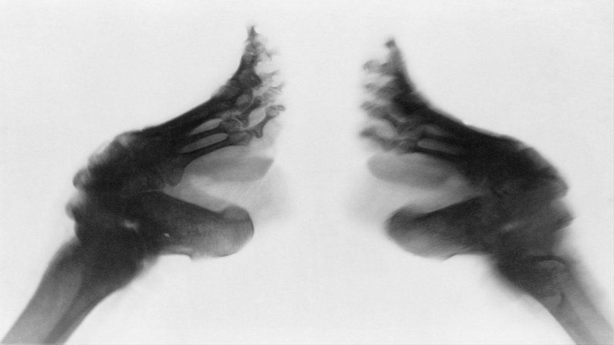 Tarih Boyunca Güzelleşmek Uğruna Uygulanan Acı Verici Yöntemler