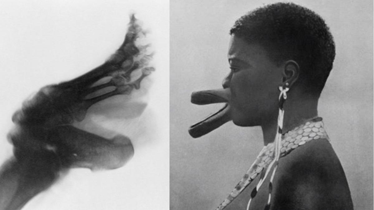 Tarih Boyunca Güzelleşmek Uğruna Uygulanan Acı Verici Yöntemler