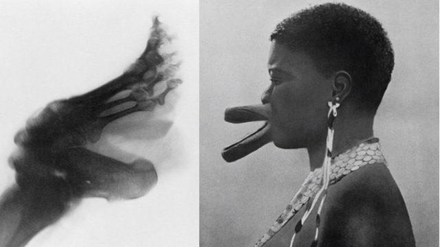 Tarih Boyunca Güzelleşmek Uğruna Uygulanan Acı Verici Yöntemler