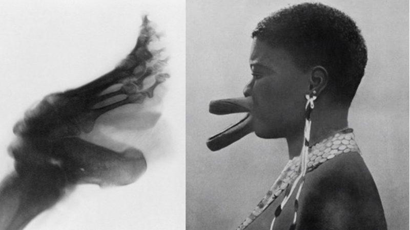 Tarih Boyunca Güzelleşmek Uğruna Uygulanan Acı Verici Yöntemler