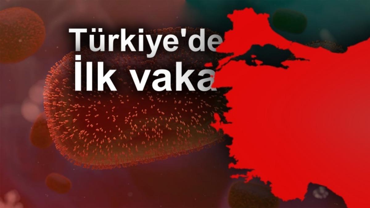 SON DAKİKA: Türkiye’de İlk Maymun Çiçeği Vakası Görüldü