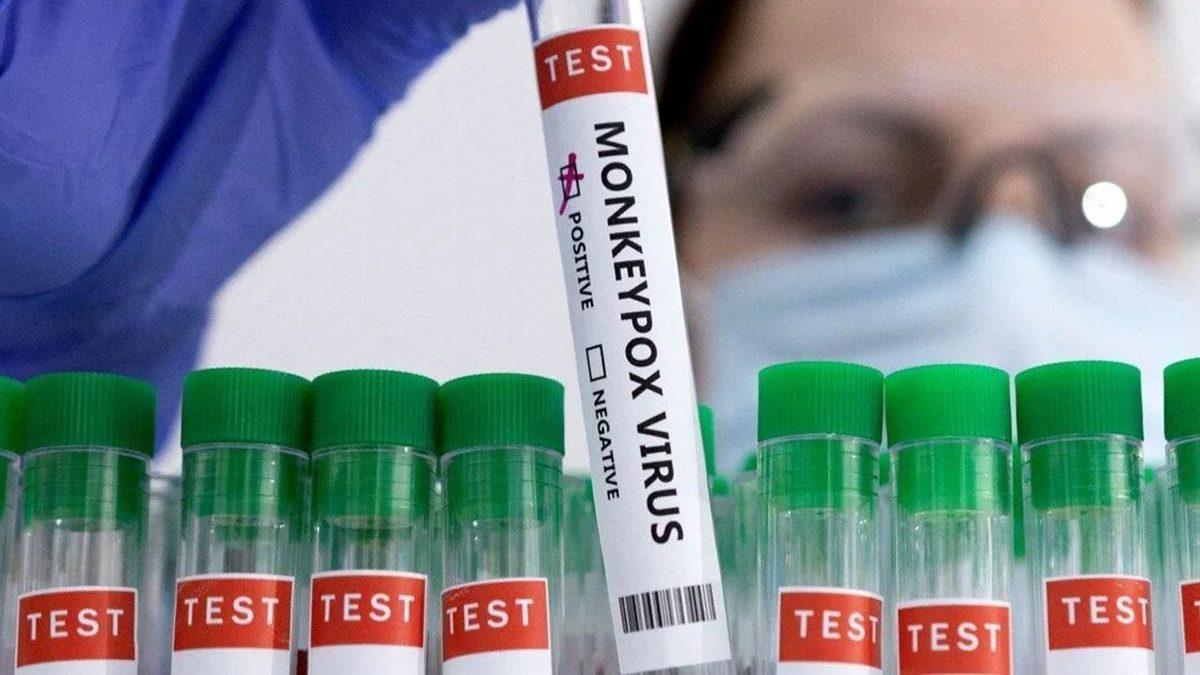 Dünya Sağlık Örgütü’nden Korkutan Açıklama: Maymun Çiçeği Vakaları Artmaya Devam Ediyor!