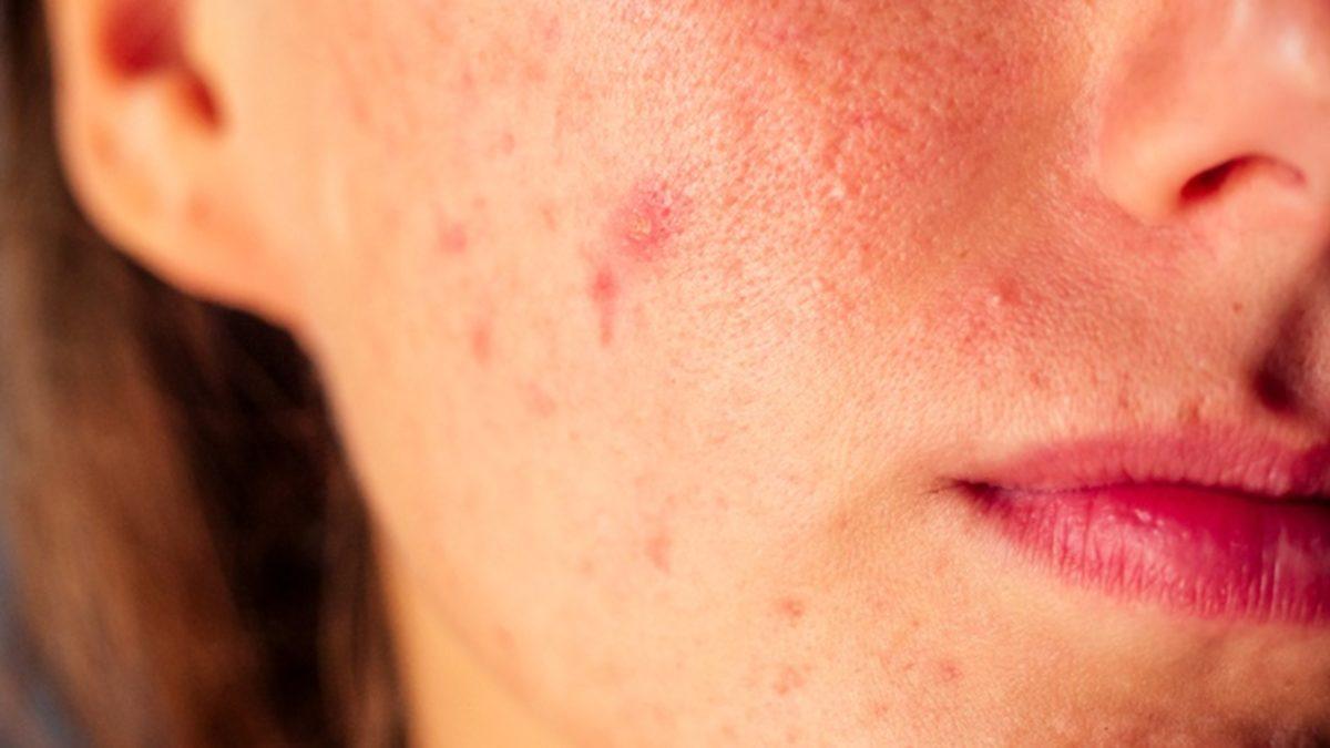 Sadece Düşünme Şekliniz Bile Vücudunuzu Hasta Edebilir veya İyileştirebilir! Peki ama Nasıl?