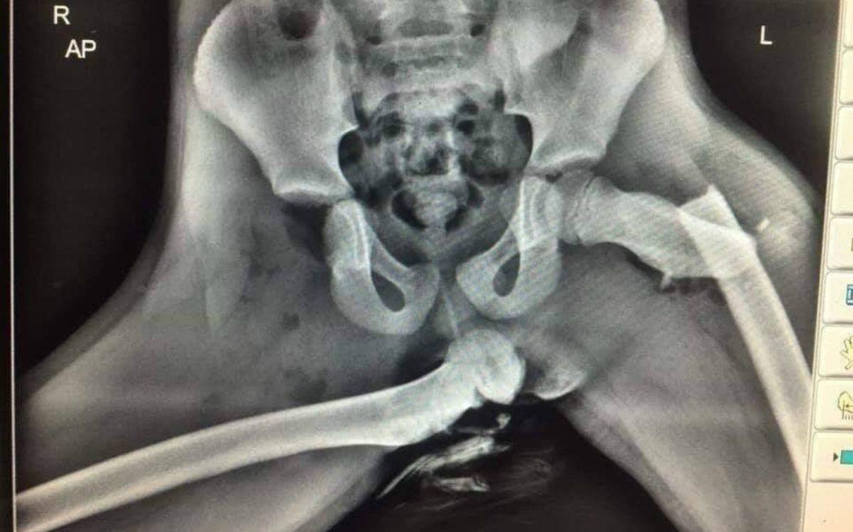 Hassas Bünyelerde Kalp Çarpıntısına Neden Olabilecek 22 X-ray Görüntüsü