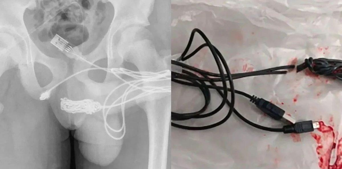 Hassas Bünyelerde Kalp Çarpıntısına Neden Olabilecek 22 X-ray Görüntüsü