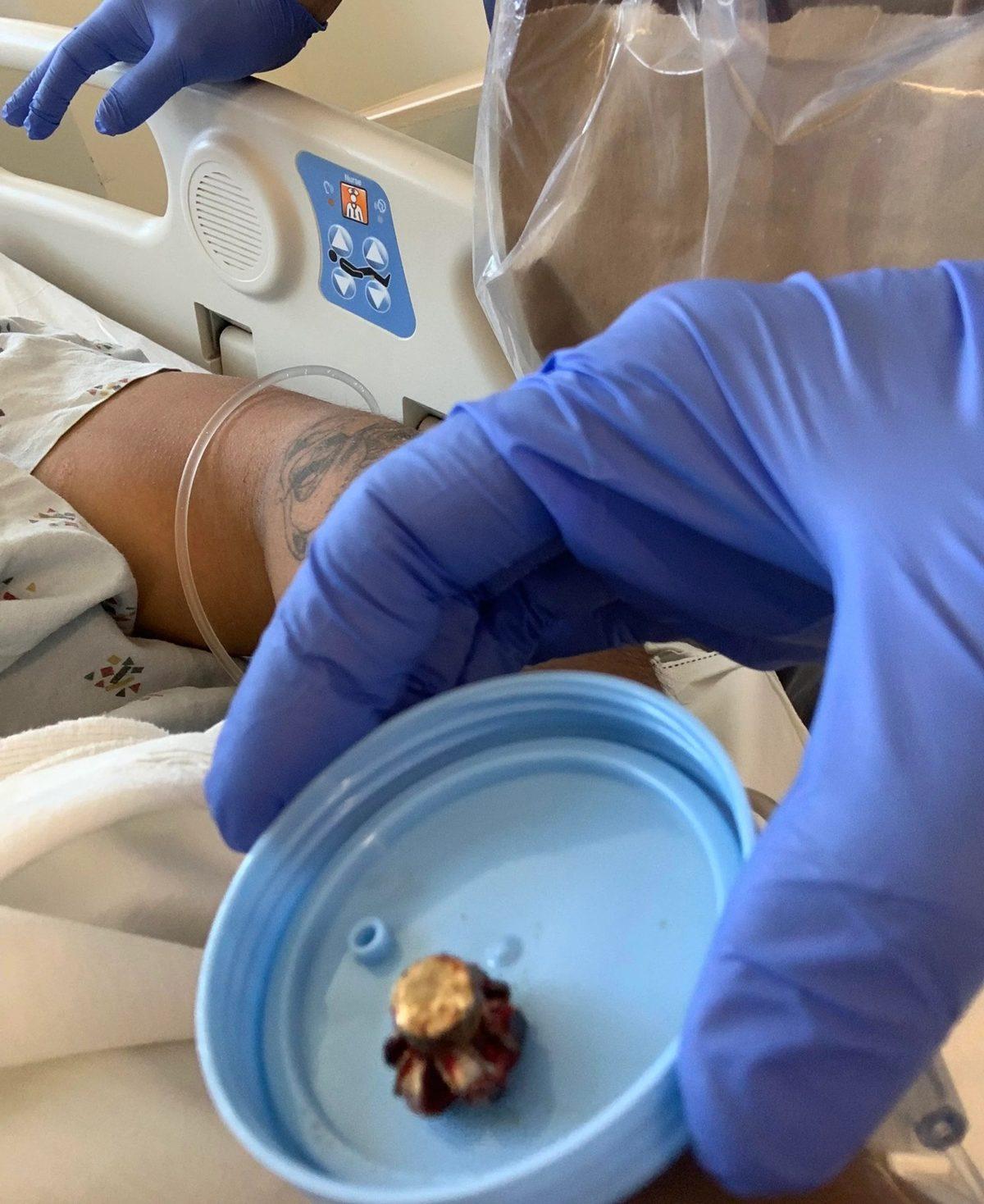 Hassas Bünyelerde Kalp Çarpıntısına Neden Olabilecek 22 X-ray Görüntüsü