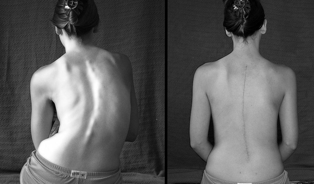 Hassas Bünyelerde Kalp Çarpıntısına Neden Olabilecek 22 X-ray Görüntüsü