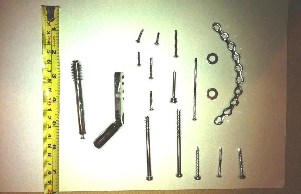 Hassas Bünyelerde Kalp Çarpıntısına Neden Olabilecek 22 X-ray Görüntüsü