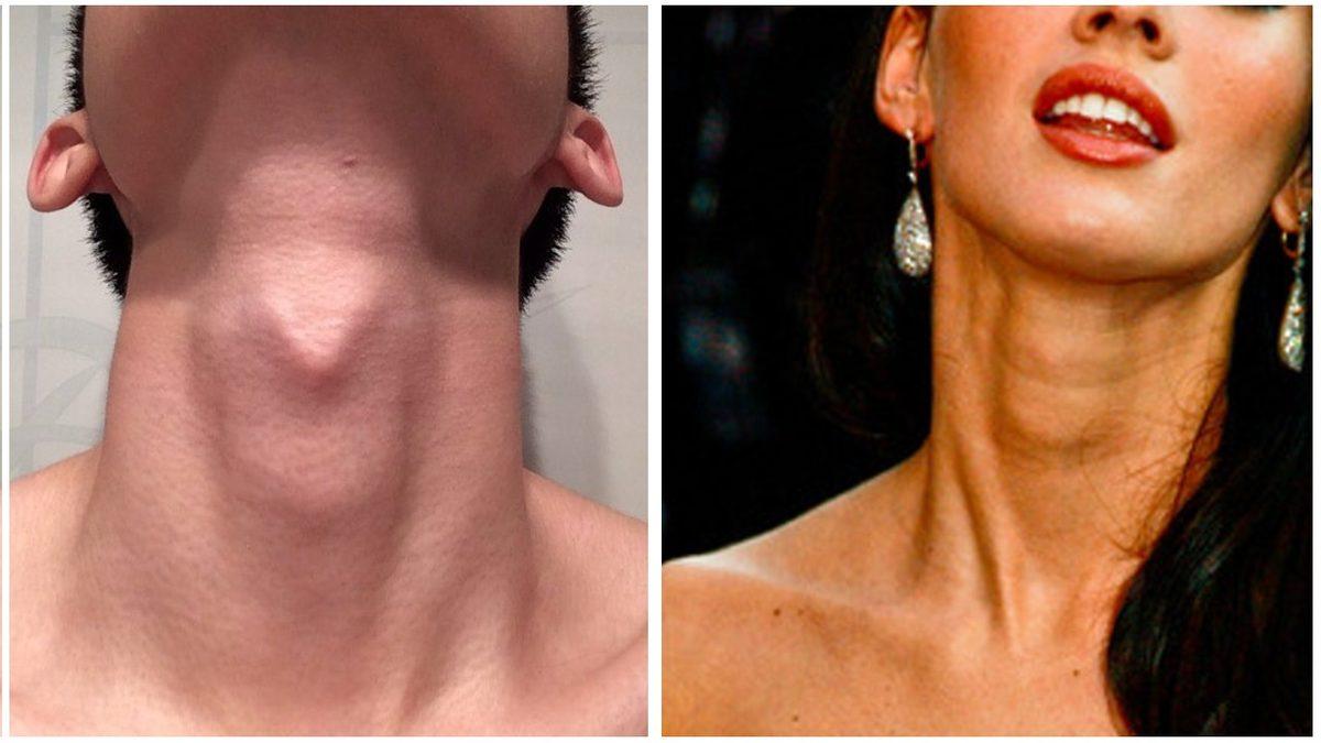 Aslında Kadınlarda da Âdemelması Var: Peki Neden Erkeklerdeki Kadar İri Görünmüyor?