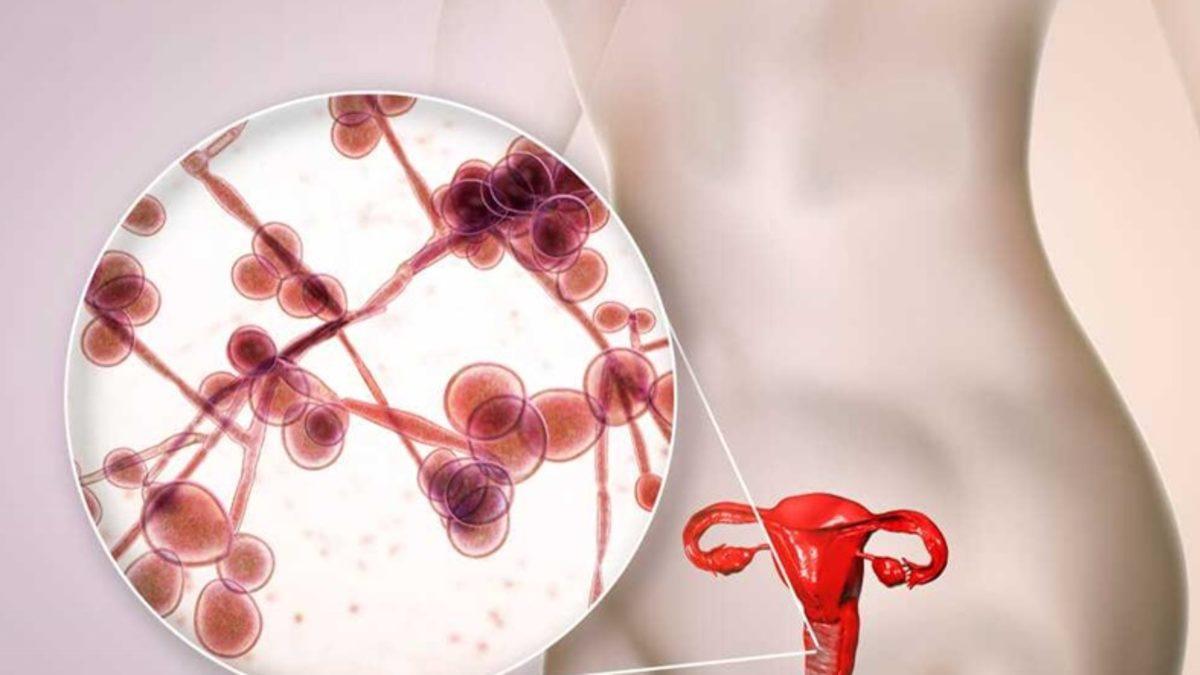 Cinsellikle Bulaşan ve Hayatınızı En Az HPV Kadar Olumsuz Etkileyen ’HSV Virüsü’ Hakkında Bilmeniz Gerekenler