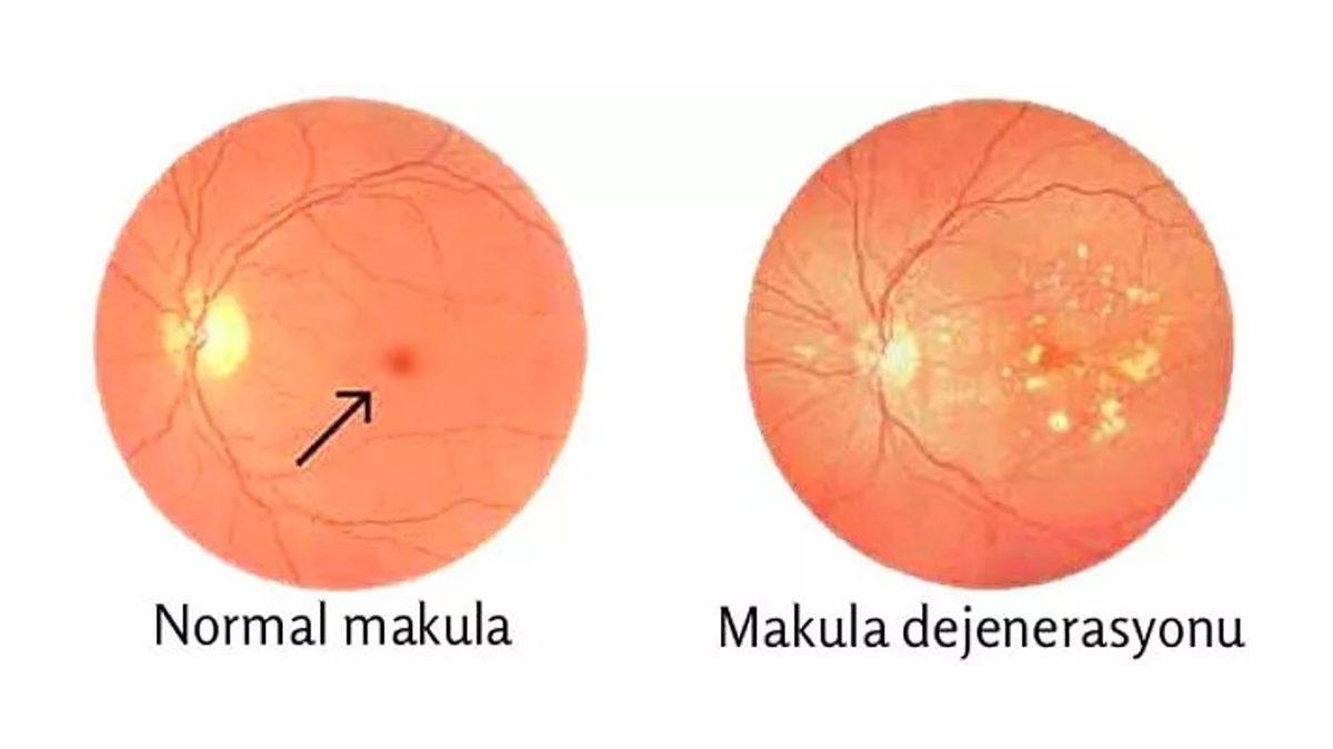 Ucuz Güneş Gözlüklerinin Gözünüze Verdiği Zararları Öğrenince Kullanmaya Tövbe Edeceksiniz!