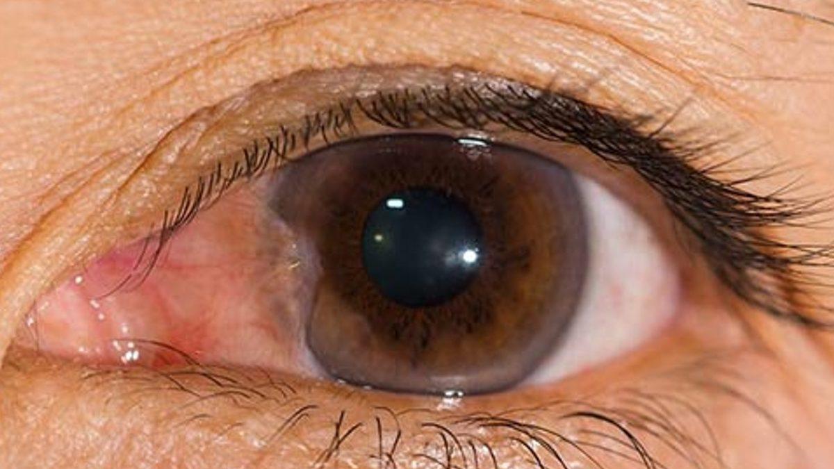 Ucuz Güneş Gözlüklerinin Gözünüze Verdiği Zararları Öğrenince Kullanmaya Tövbe Edeceksiniz!