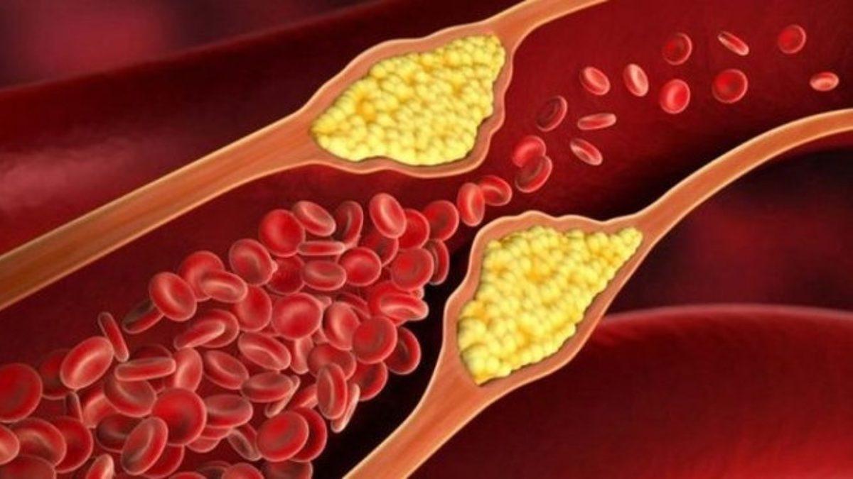 Genetik Bilimciler, Dünyanın En Ölümcül Hastalıklarından Birini Ortadan Kaldırabilecek Bir Tedavi Geliştirdi