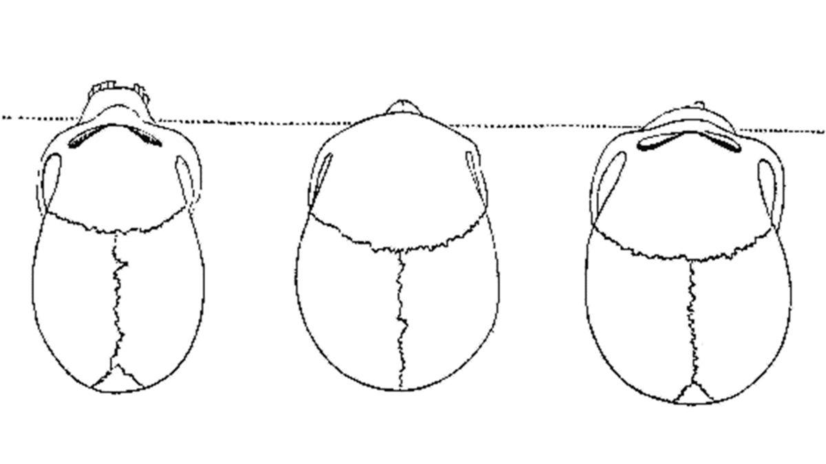 Mimar Sinan’ın Kafatası Neden Kayıp? 87 Yıldır Çözülemeyen Gizemin Az Bilinen Öyküsü