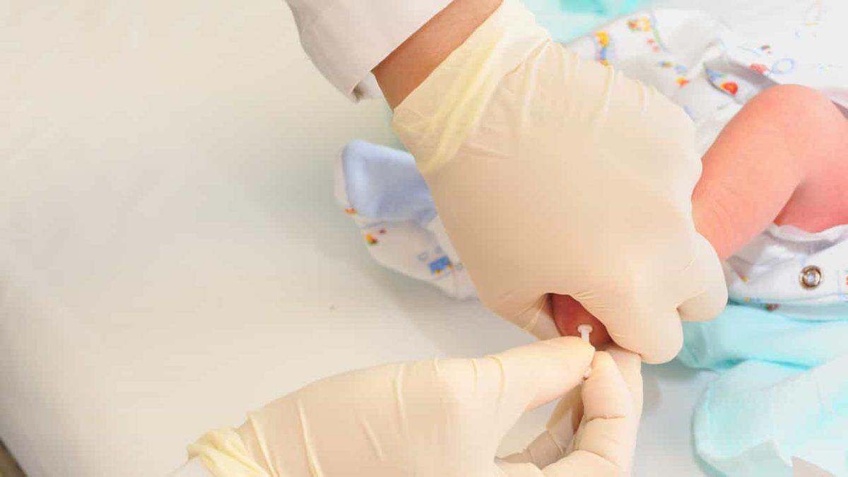 Nadir Hastalıklardan Fenilketonüri Nedir? Nasıl Teşhis Edilir?